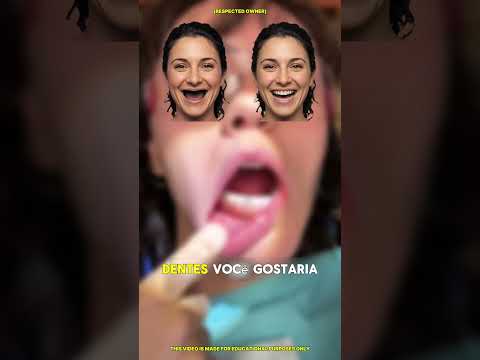 Os Dentes Quebraram ao Meio Durante a Escovação! 😨🦷 #shorts