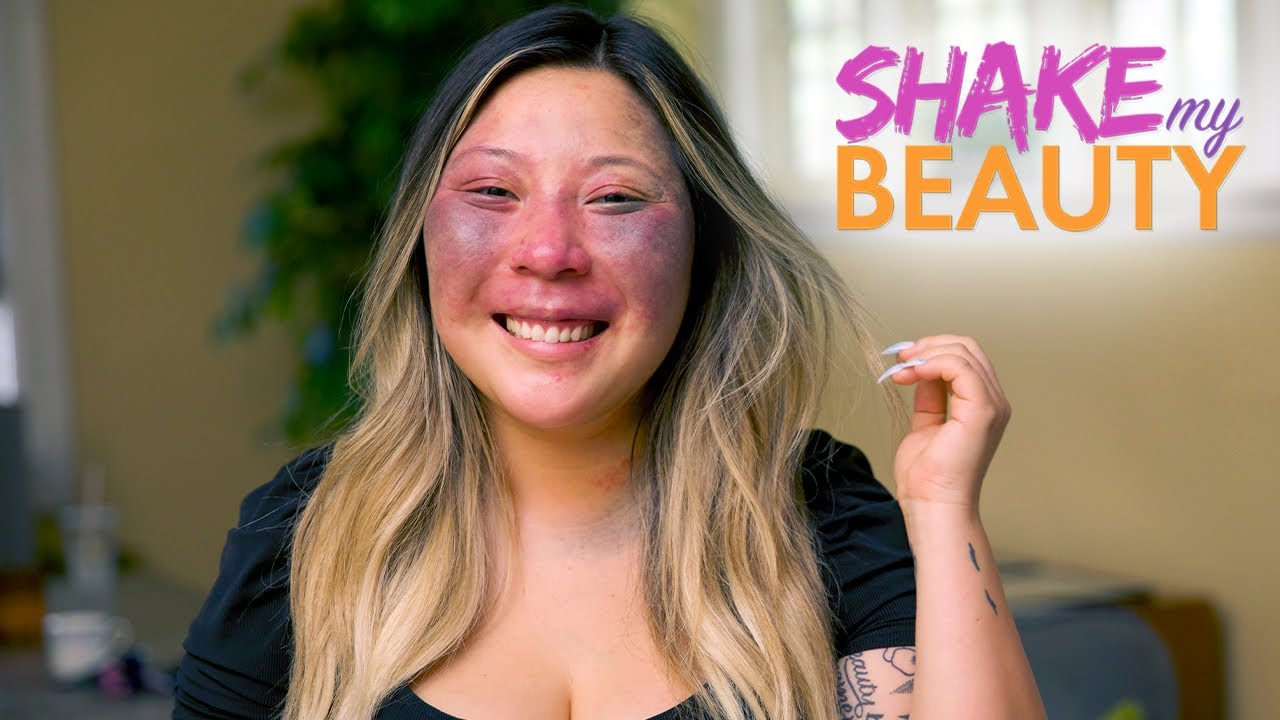 Revealing my birthmark on a date - shake my beauty