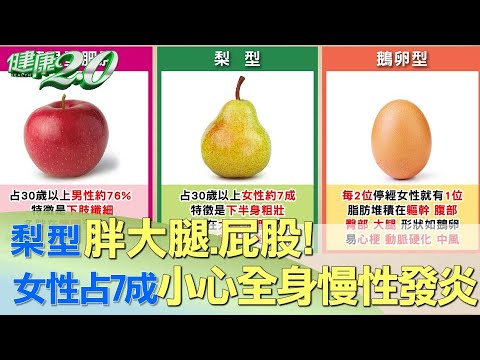 梨型胖大腿.屁股！女性占7成 小心全身慢性發炎 健康2.0