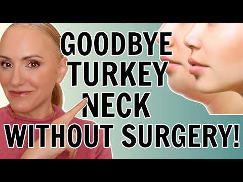 How To Get Rid Of Turkey Neck - NO SURGERY or EXPENSIVE TREATMENTS!