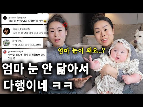 "엄마 눈 안 닮아서 다행이네ㅋㅋ" 5번의 전신마취.. 수술로 생긴 눈 상처 최초 공개 | 내가 평생 눈을 못 감는 이유는?