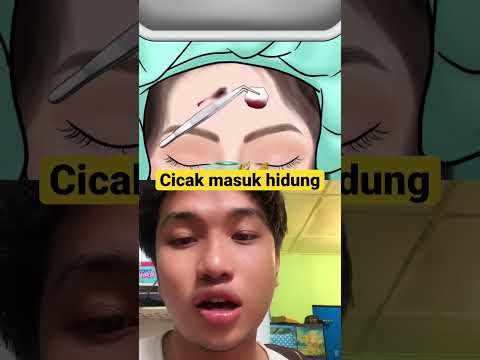 CICAK MASUK HIDUNG #viral