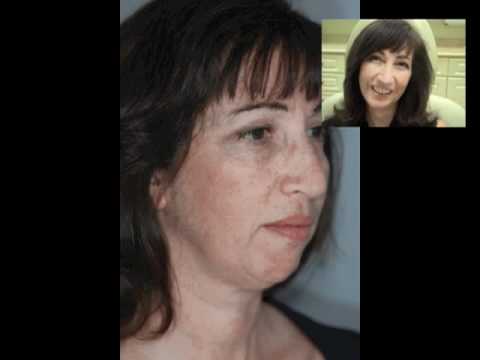 Before and after photos of a smiling woman