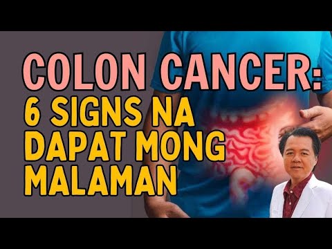 Sa Colon Cancer: 6 Signs na Dapat Mong Malaman (Repost Video)