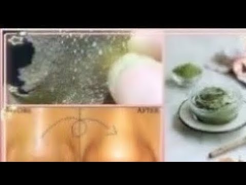 اسهل الطرق لإزالة الرؤوس السوداء من الانف و من الوجه بأكمله في دقائق|مضمونة و فعالة من اول مرة