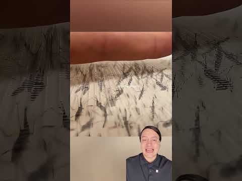 por eso algunos atraen mas a los mosquitos