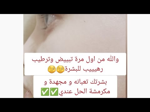 يتوزن بالذهب تبييض وترطيب فورى وسريع وهيخليكي متحطيش ولا نقطة ميكب✅️