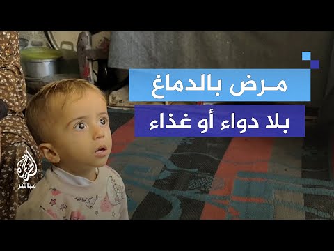 ذو عامين.. معاناة طفل فلسطيني مريض في ظل الحرب