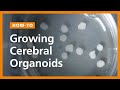 Cerebral Organoid Development Stages
