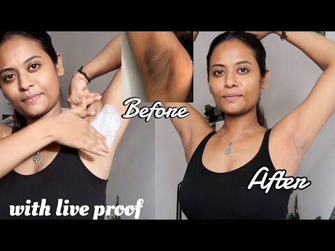 Home remedies to whiten your underarm in 1 ues with Live proof | topnotch beauty tips