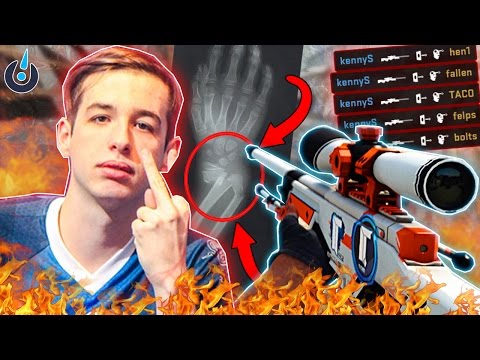 ODDSHOTS #13 - KENNYS WRIST BREAKING FLICKS!! HE'S BACK?! TEAM CAUGHT THROWING?! KIO INSANE 1v4!!