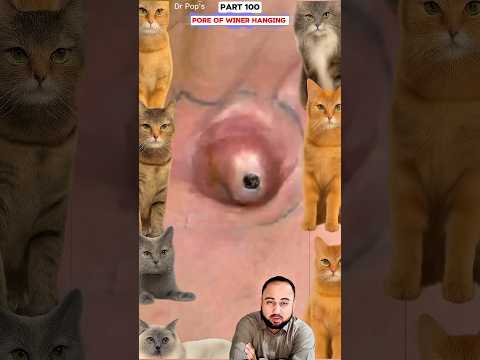 “You Won’t Believe This Pore of Winer! Too Satisfying #shortsfeed #shorts