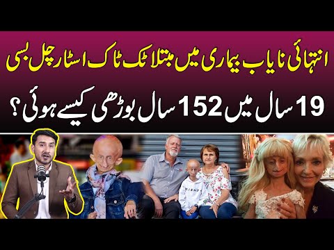 Inspirational Tiktoker Jo 19 Year Ki Age Mein 152 Years Ki Ho Gai | Kesy? Janiye