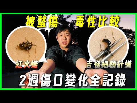 以身試毒!! 給紅火蟻vs吉悌細顎針蟻螫｜哪種痛？哪種危險？｜2週傷口全記錄【臺灣蟻窟】