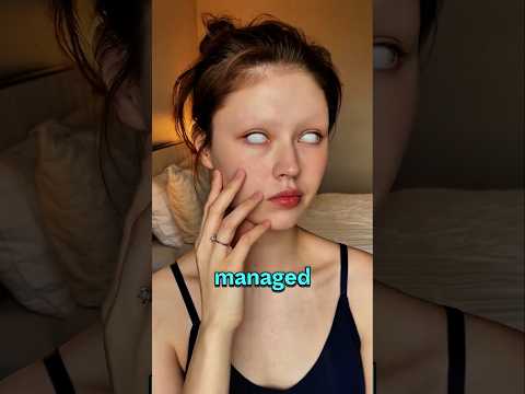 This woman is trying to look ugly 😱