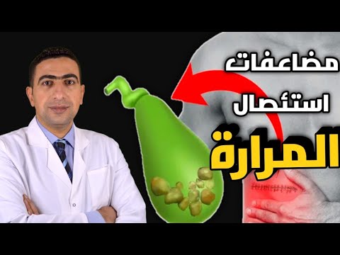 المرارة | عملية استئصال المراره ومضاعفاتها علي الجسم علي المدي الطويل | اعراض مابعد ازالة المرارة