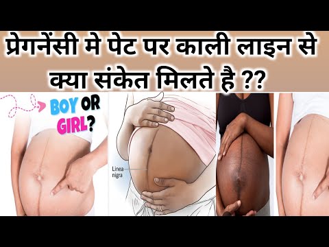 प्रेगनेंसी मे पेट पर काली लाइन से क्या संकेत मिलते है ?Linea nigra during pregnancy boy or girl