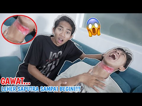 Waduh! Leher Saputra Tersangkut T4li Layangan Sampe Begini?? | Mikael Family