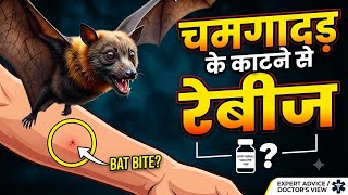 ⁠Chamgadar ke katne se Rabies hota hai? | Bat Bite Rabies Vaccine Protocol in India