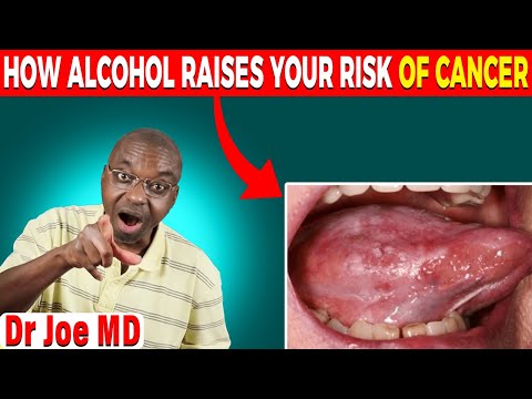 The Alcohol and Cancer Connection: A Medical Doctor Explains