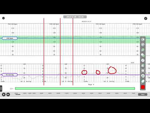 Interactive Fetal Heart Monitor Player