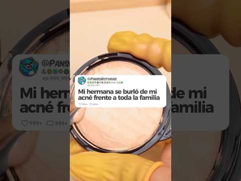 Mi hermana se burló de mi acné frente a toda la familia 😭 #youtubeshorts #shortvideo