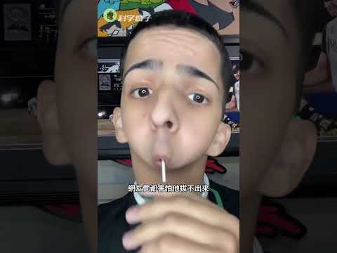 他沒有下巴，卻成了說唱歌手