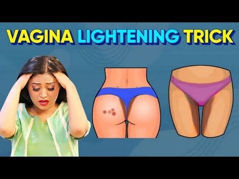 Girl's Private Body Parts Brightening 🤔 Dark Butt, Vagina, Underarms, Neck Ko Kaise Gora Kare? Gtalk