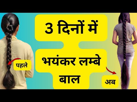 डॉक्टर भी हैरान है, 5 रातो मे बाल जमीन तक लंबे कैसे हो गये है, Powerful Hair Growth serum, Long Hair