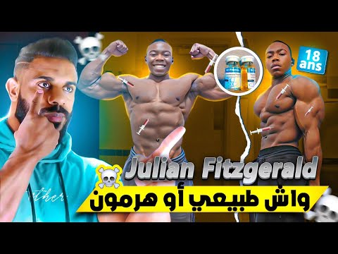 هل هم طبيعيون 🤔 : الوحش Julian_Fitzgerald واش طبيعي أو دوباج 💉