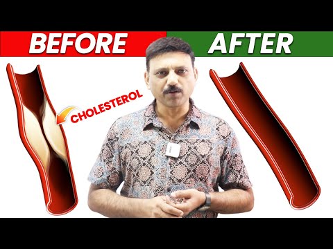CHOLESTEROL को कुछ ही दिनो में पिघला देगा आयुर्वेद का ये करिश्माई चूर्ण | Manas Samarth