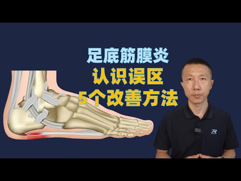 足底筋膜炎的认识误区以及5个改善方法