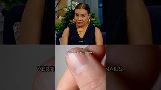 What Your Nails Say About Your Health 👀💅