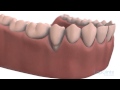 Gum Health and Care Practices