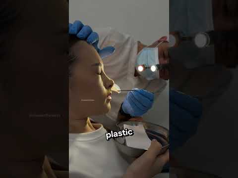 Why Doctors Put Things Inside Noses⁉️😱