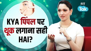 Tamannaah Bhatia Pimple Hack: Acne से छुटकारा पाने का आसान तरीका | Viral | Desi Acne Treatment