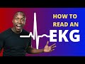 Heart Electrical Activity and EKG Interpretation