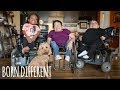 Understanding Osteogenesis Imperfecta and the Lamereaux-Ferrero Family