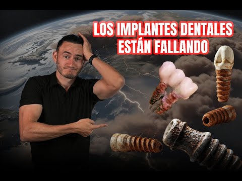 ¡Los implantes dentales están fracasando! 😱