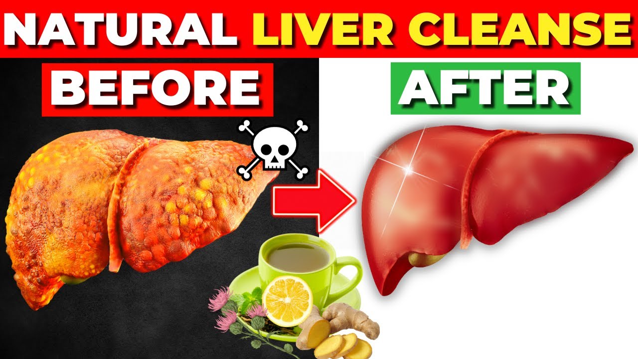 Say Goodbye to Fatty Liver With These Superfoods! (Best Liver Cleanse)