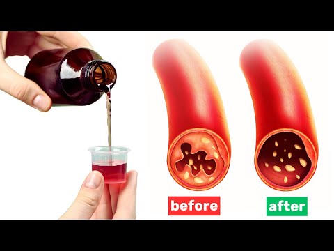 Syrup That CLEANS Arteries and PREVENTS Blood Clots?