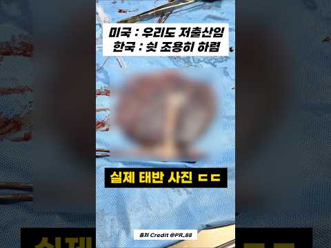 아이를 낳는 게 힘든 이유