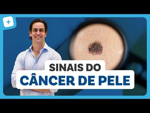 CÂNCER DE PELE: tipos, sinais, tratamento e como prevenir