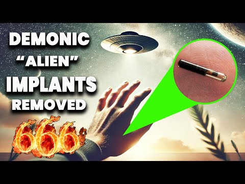 NEW! Evidence Links 17 Demonic "Alien" Implants to the Mark of the Beast