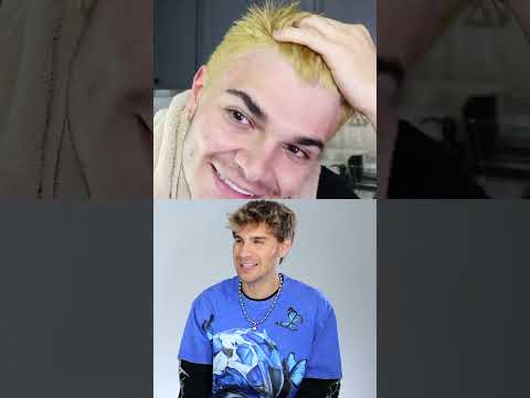 Hairdresser Reacts to Chemical Burn Bleach Fails