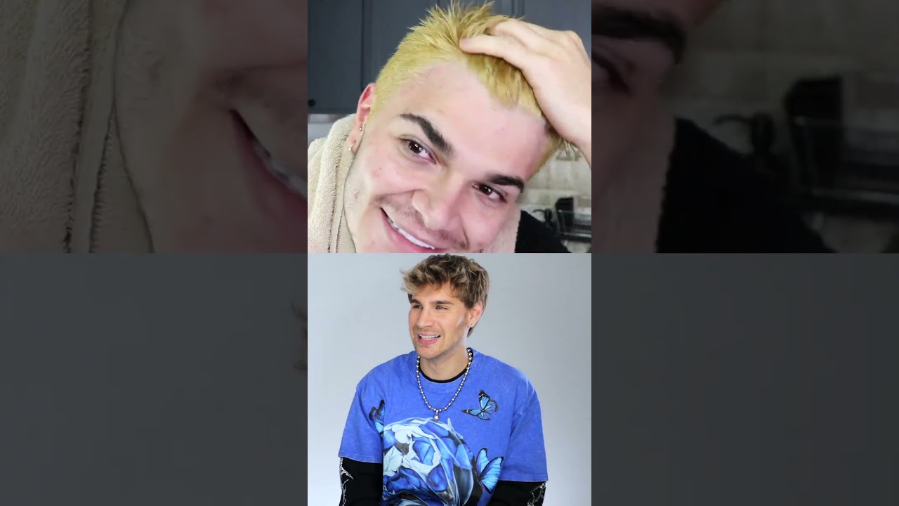 Hairdresser Reacts to Chemical Burn Bleach Fails