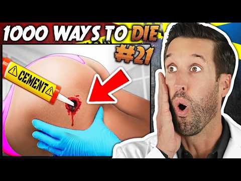 ER Doctor REACTS to 1000 Ways to Die Dumbest Injuries #21