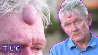 Ne Zaman Geçecek Bilmiyorum  | Doktor Çıbanım - Dr. Pimple Popper