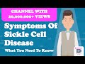 Sickle Cell Disease Complications and Symptoms
