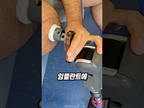 티타늄 임플란트를 다리에 박는 이유